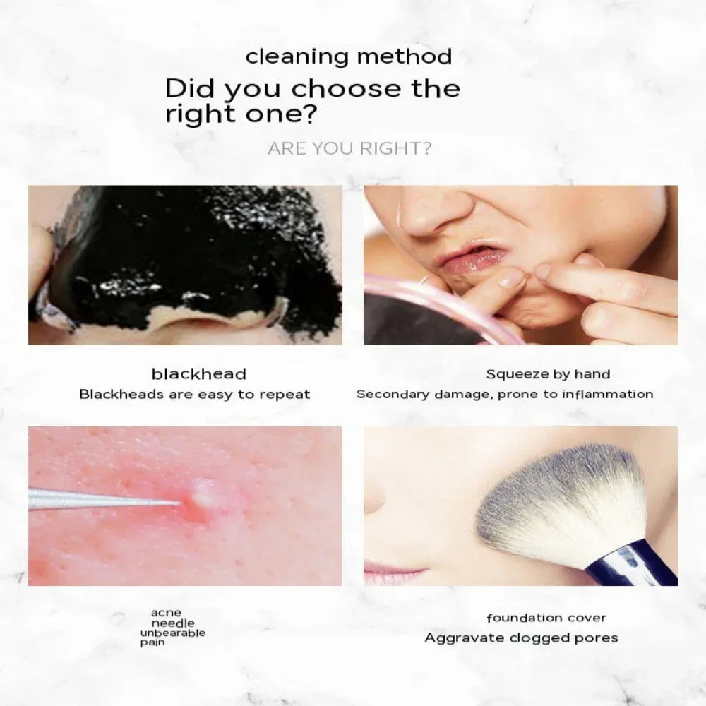 Ultrasonic Skin Care Scraper Blackhead Remover